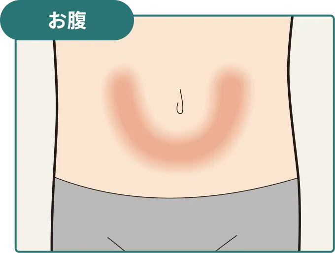 腹部の注射部位を示した図