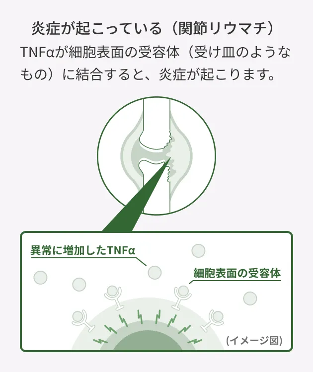 関節内で異常に増加したTNFαが細胞表面の受容体に結合し、炎症を引き起こすしくみを示したイメージ図。