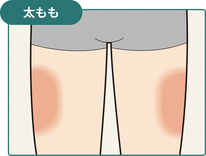 太ももの注射部位を示した図