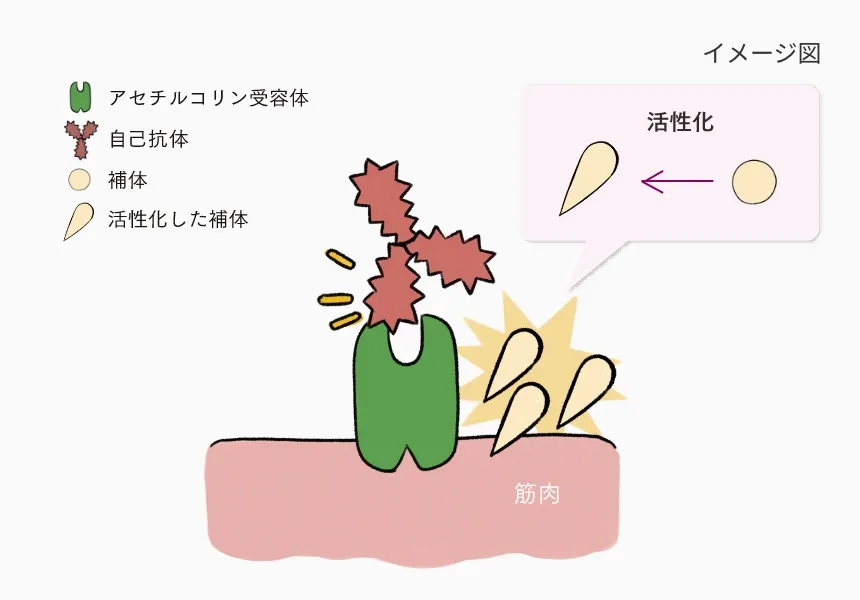 自己抗体により補体が活性化し筋肉の受容体が攻撃されるMGの仕組みを示した図