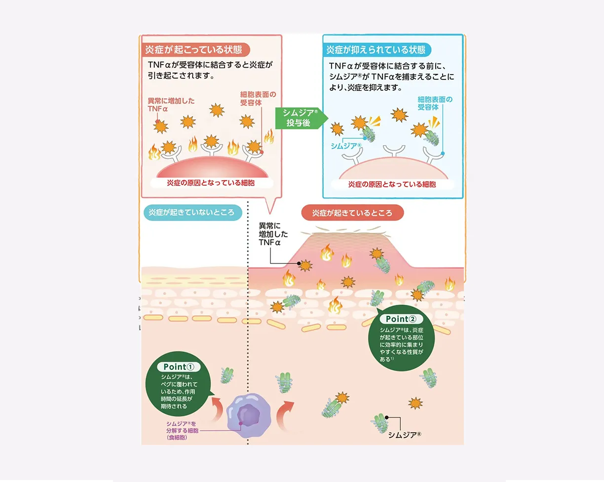 シムジア®がTNFαを捕捉して炎症を抑える仕組みを示した模式図
