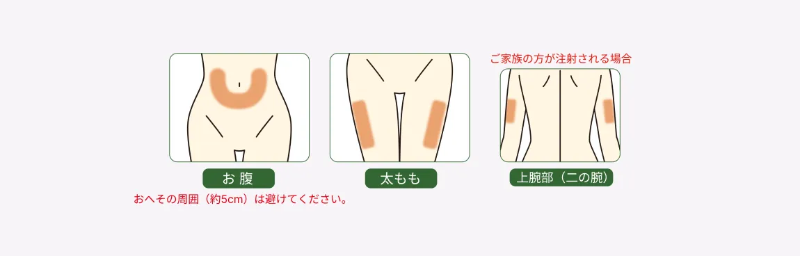 注射する部位を色で示した図。ご自身で注射する場合はお腹または太もも、ご家族が注射する場合は上腕部(二の腕)も使用できる。お腹に注射する場合は、おへその周囲約5cmを避ける。