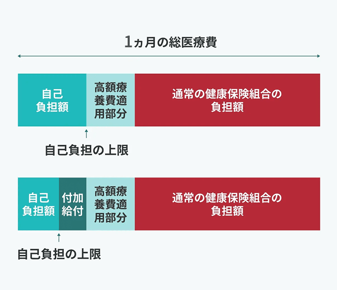 高額療養費制度と付加給付制度による医療費の支払いイメージを示した図