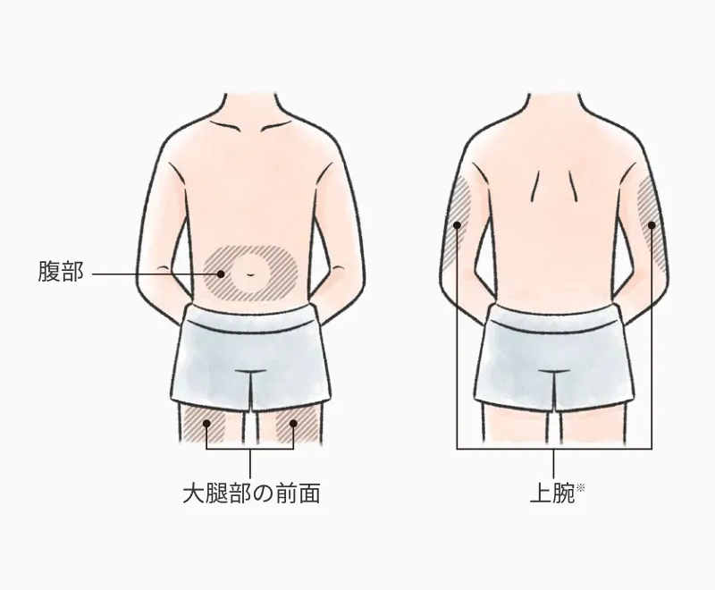 腹部・大腿部前面・上腕など自己注射が可能な部位を示した図