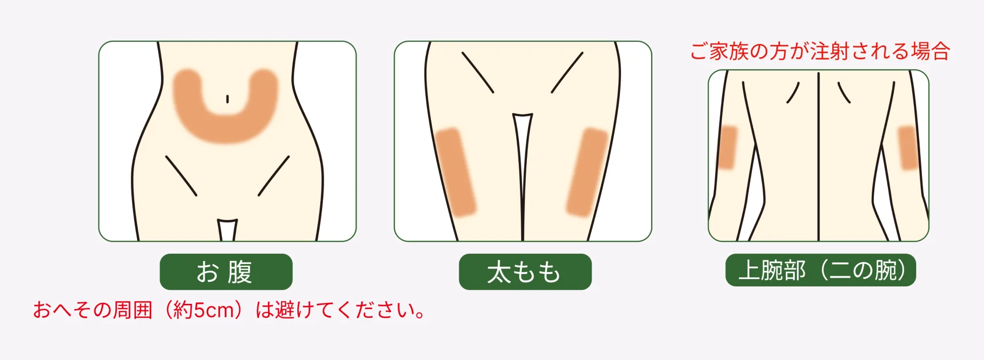 注射する部位を色で示した図。ご自身で注射する場合はお腹または太もも、ご家族が注射する場合は上腕部(二の腕)も使用できる。お腹に注射する場合は、おへその周囲約5cmを避ける。