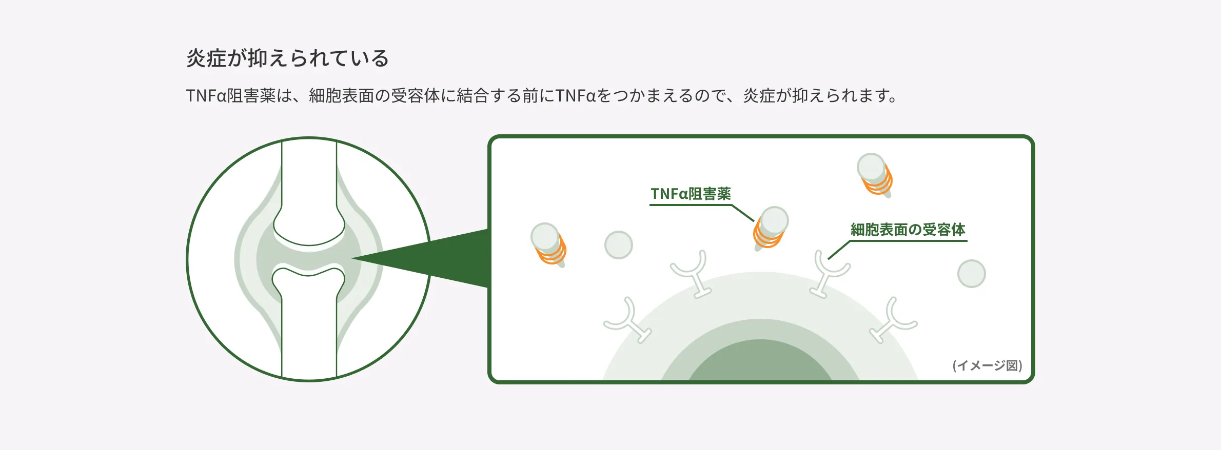 TNFα阻害薬がTNFαを捕まえ、細胞表面の受容体への結合を防ぐことで、関節の炎症を抑えるしくみを示したイメージ図