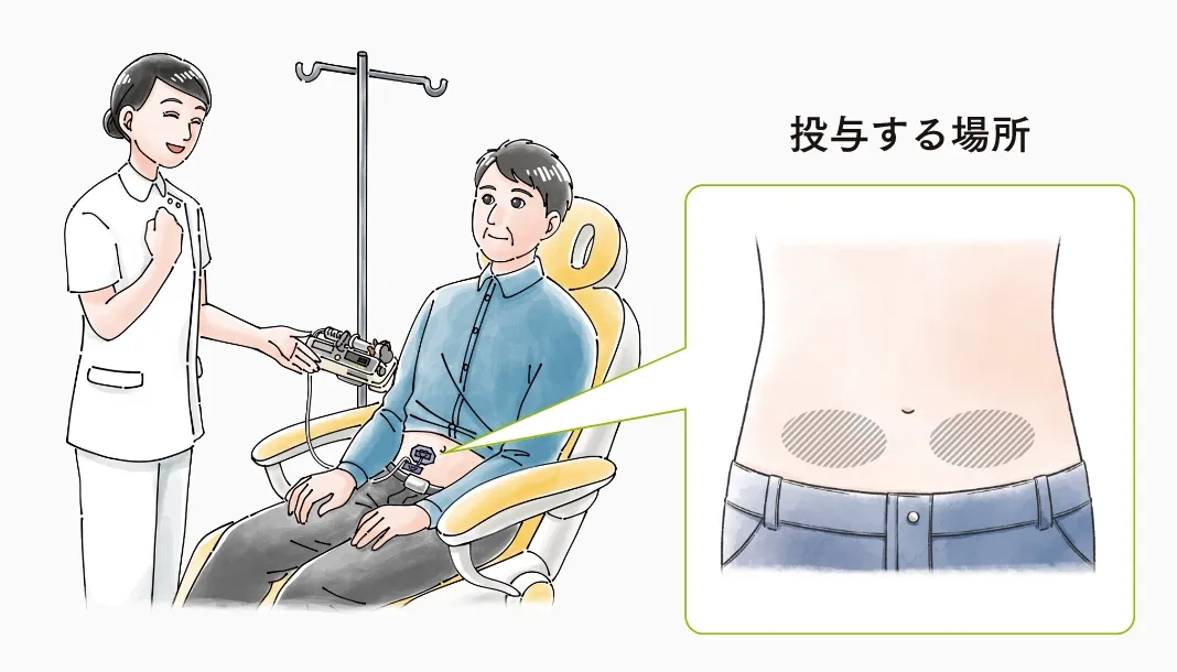 投与する場所