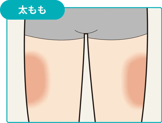 大腿部の注射可能部位を示した図