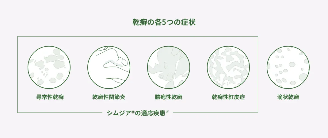 乾癬の5種類(尋常性乾癬、乾癬性関節炎、膿疱性乾癬、乾癬性紅皮症、滴状乾癬)を示した図