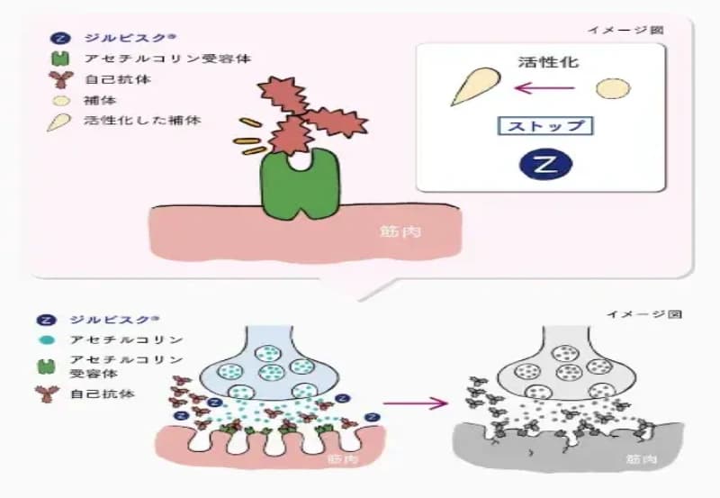 補体の活性化を阻害して筋肉への攻撃を防ぐジルビスクの作用機序を示した図