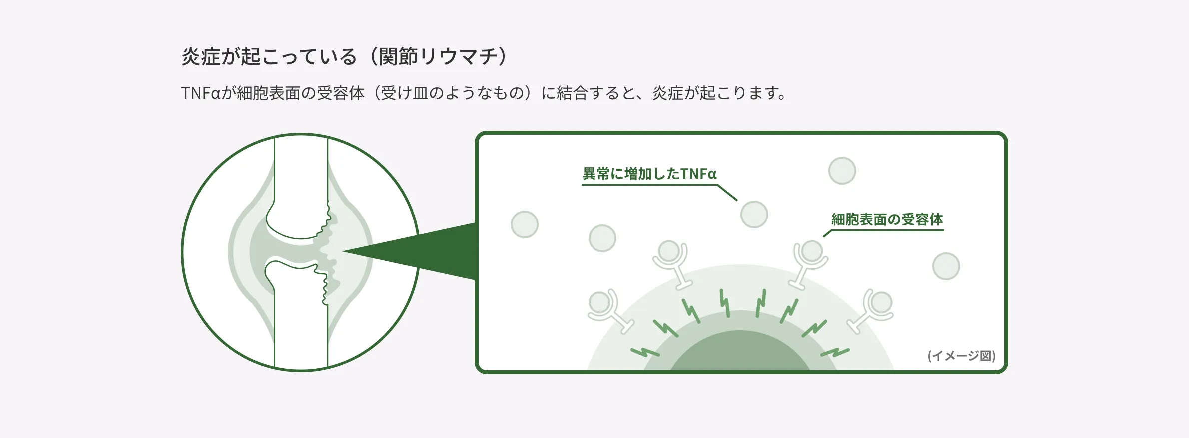 関節内で異常に増加したTNFαが細胞表面の受容体に結合し、炎症を引き起こすしくみを示したイメージ図。