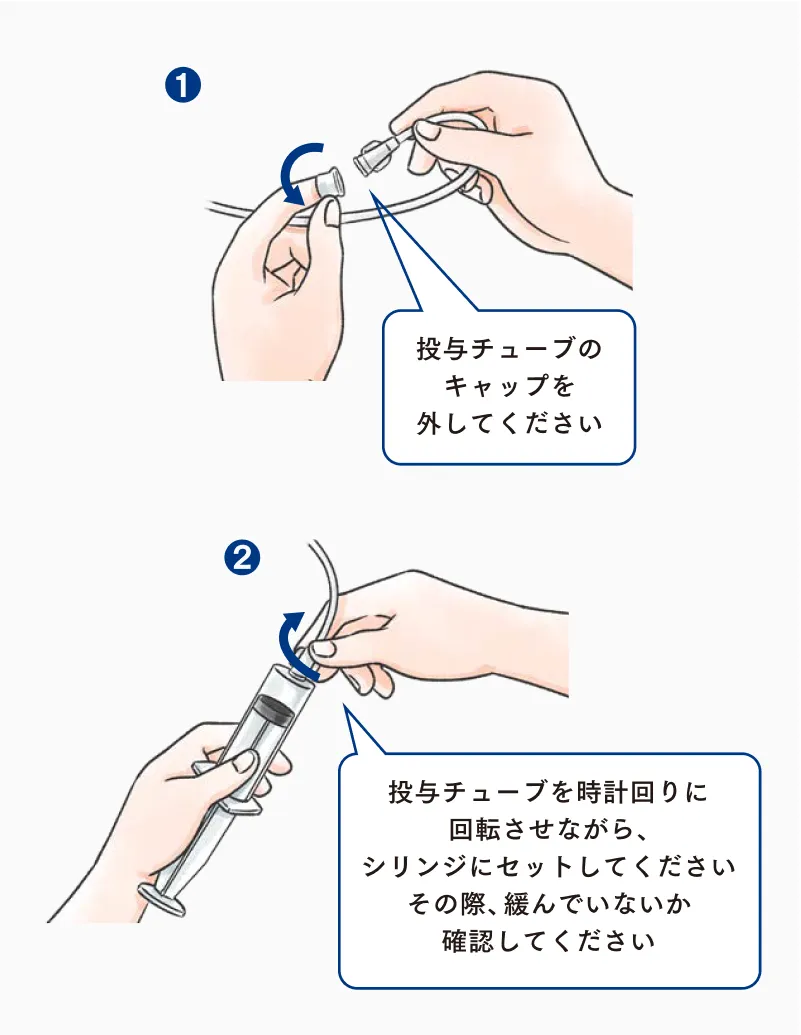 投与チューブのキャップを外し、チューブ付き翼状針を時計回りに回してシリンジに取り付ける手順