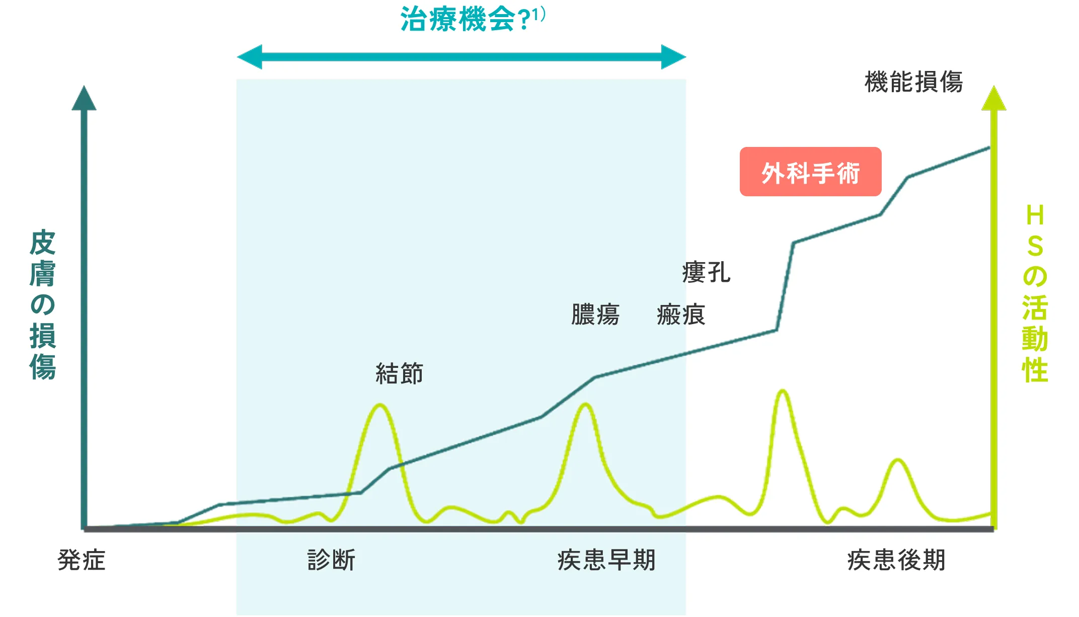 HSの最適な治療タイミングの図